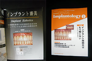 DENTAL Implantology