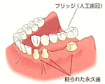 従来の治療