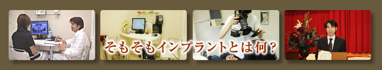 インプラントとは