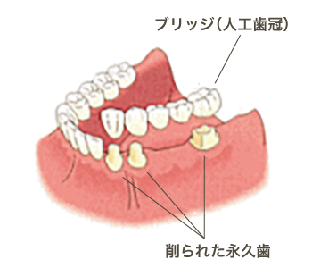 従来の治療