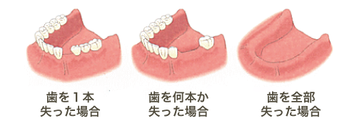 診断と治療計画